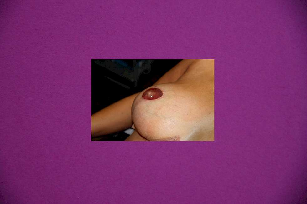 Bild Paramedizinisch Brustwarzentattoo Medizinische Brustwarzentätowierung bzw. Hof Tätowierung 3 D