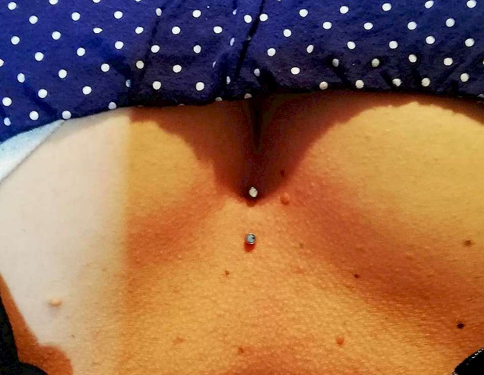 Bild Piercing oberhalb Brust Sternum Flächenpiercing