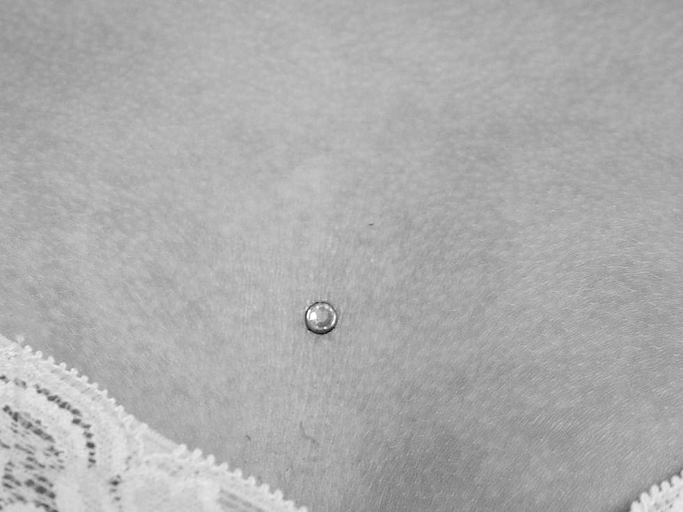 Bild Hautanker Dermal Anchor