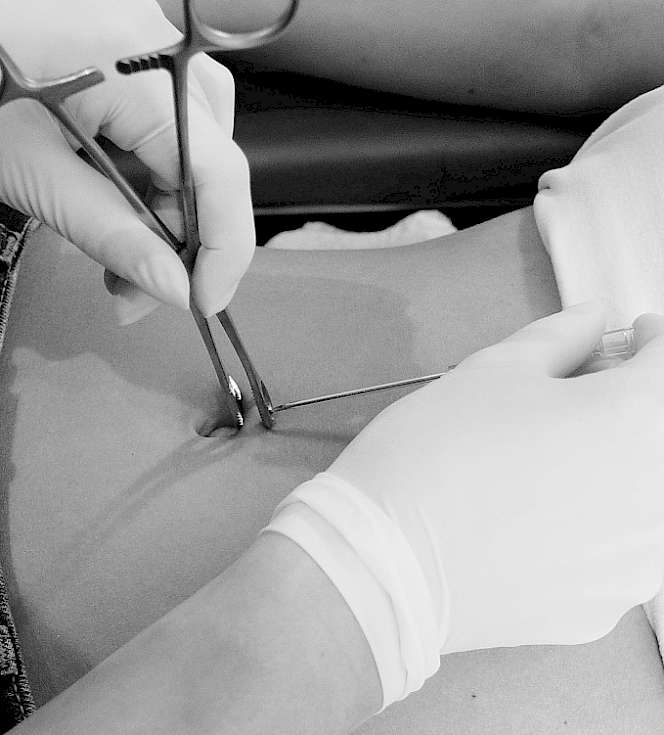Bild Beim Bauchnabel piercen