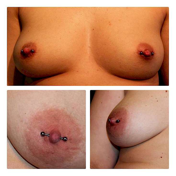 Bild Brustwarzenpiercing