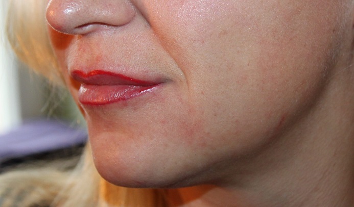 Bild Permanent Make-up Lippenkontur