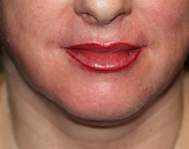 Bild Lippenkontur lippen tätowiert kontur permanent make up dresden