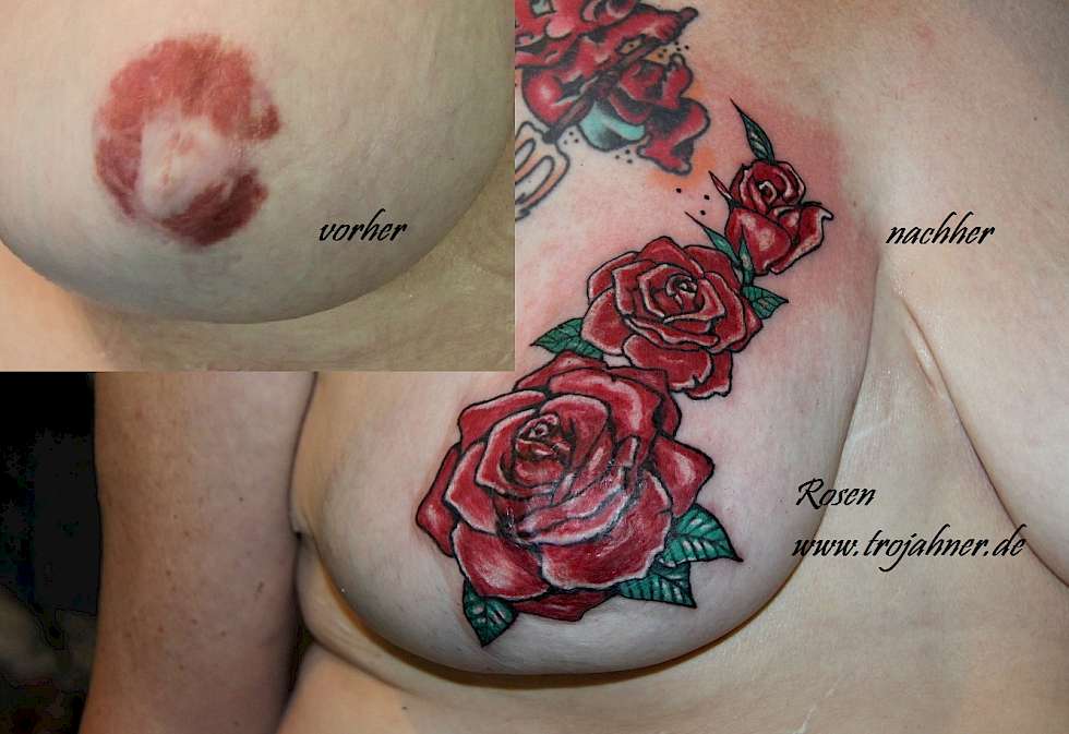 Bild Tattoo Tätowierung über narbe Brustwarze Rose