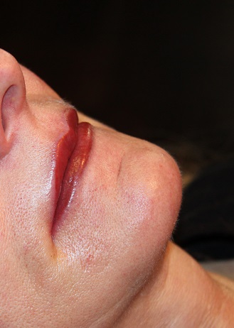 Bild Lippen dauerhaft Permanent Make up