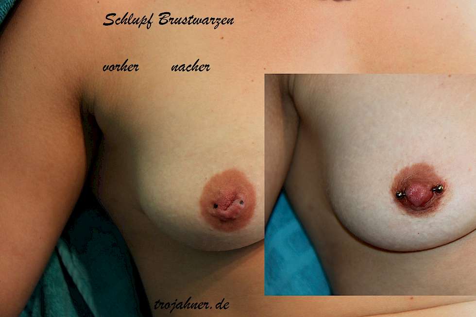 Schlupfbrustwarzen piercen Bild Piercing