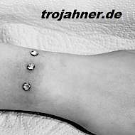 Bild Dermal Anchor Anker Hautanker