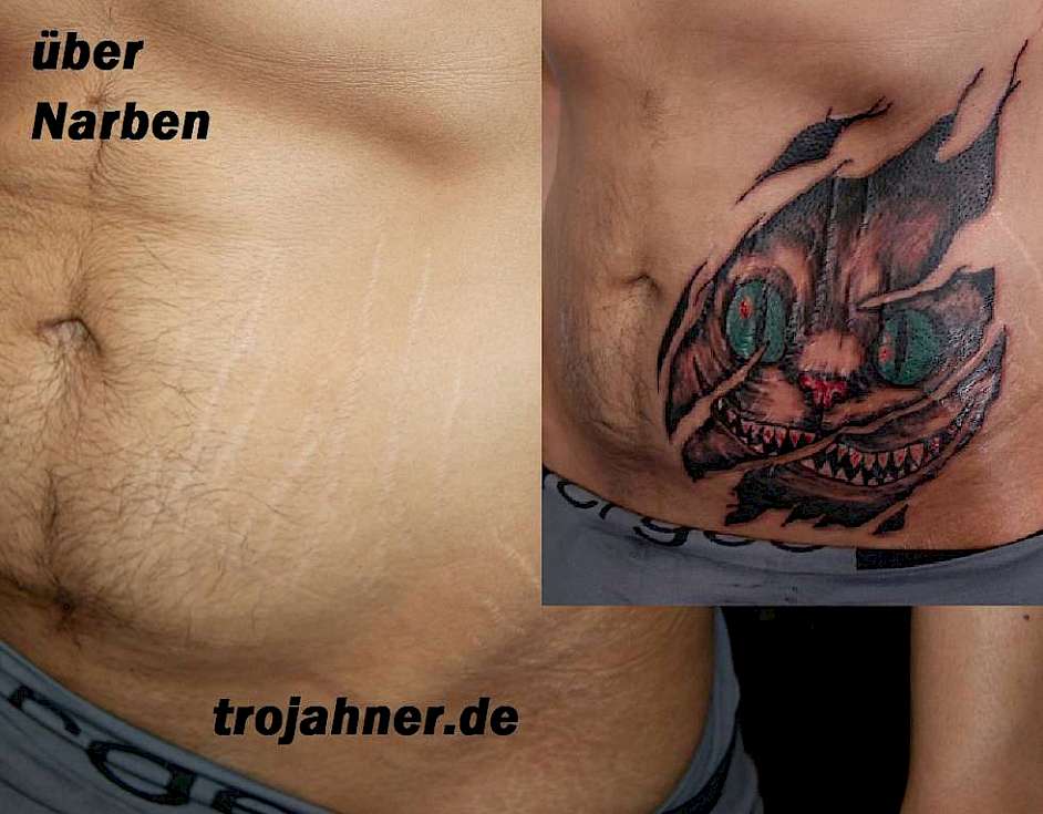 Bauch narbe tattoo am Toller Trend!