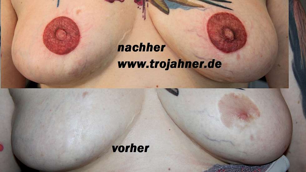 Bild Mamillen Areal  Brustwarzenpigmentierung nach OP Brustwarzen Nippel Tattoo Tätowierung