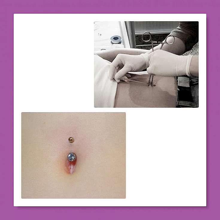 Bauchnabelpiercing piercen Bauchnabel Piercing Piercingdresden Bild Piercing